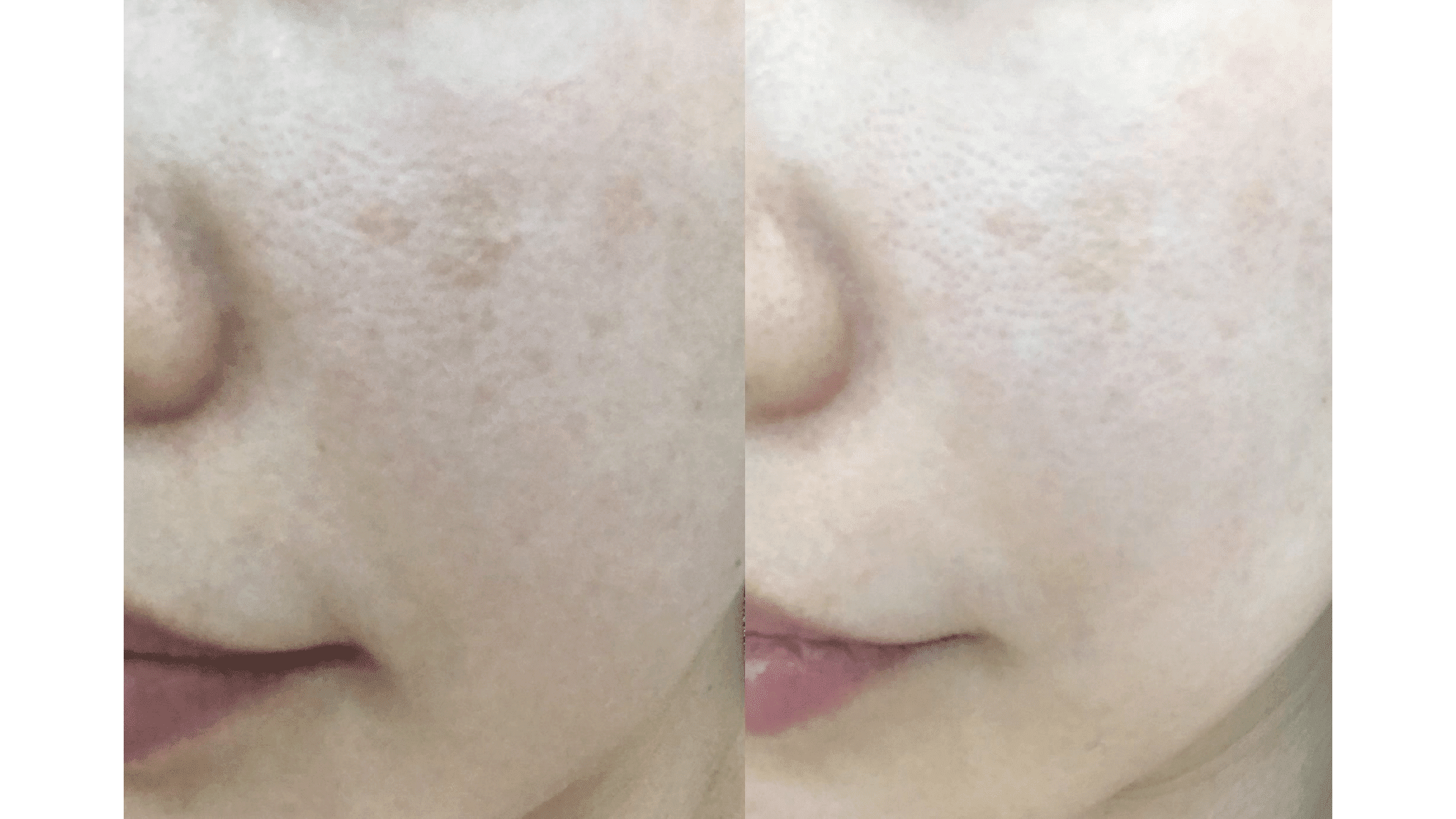 exosomes exomide xytide stem cells pigment